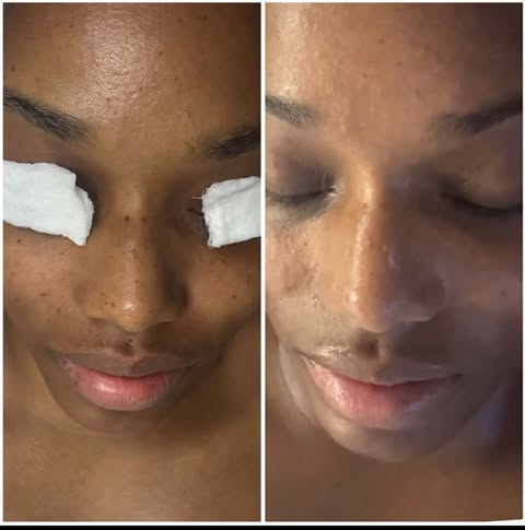 Glowing Skin Before & After
