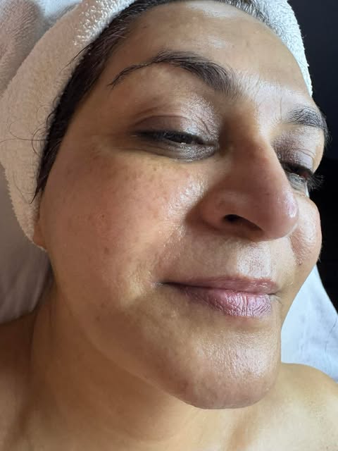 Post-Facial Glow