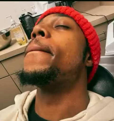 Face Wax in Progress